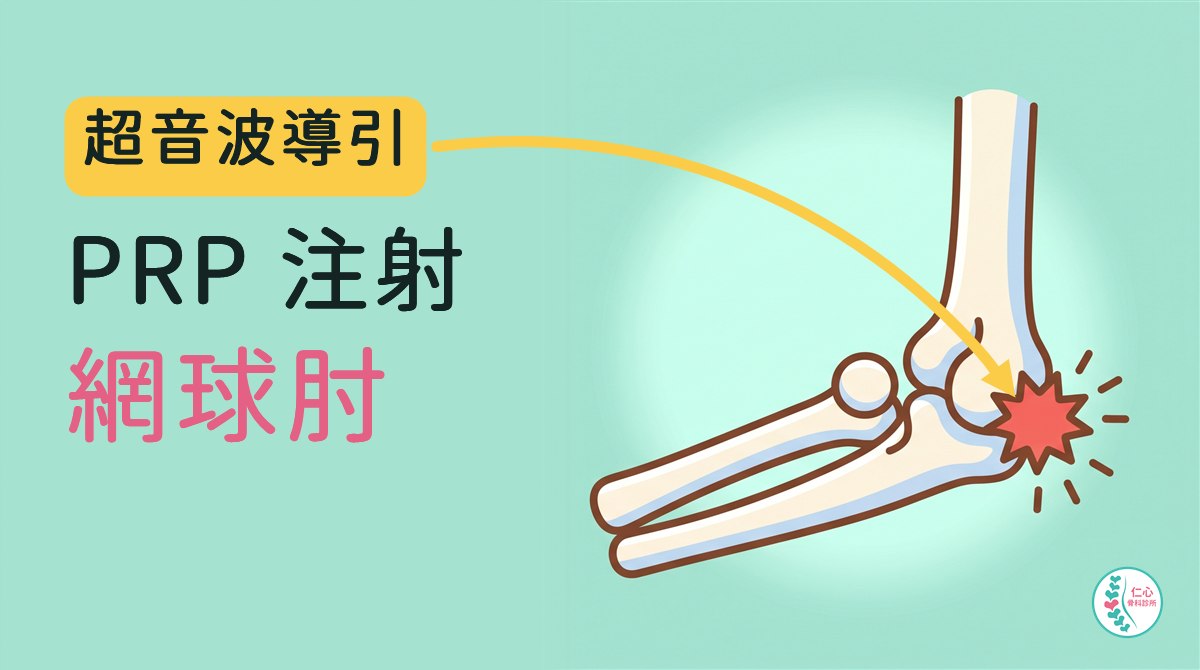插畫：可愛的卡通手肘骨頭，手肘外側有一個紅色痛點；左側大字「超音波導引　PRP 注射　網球肘」，黃色箭頭指向痛點，右下角是仁心骨科診所標誌。