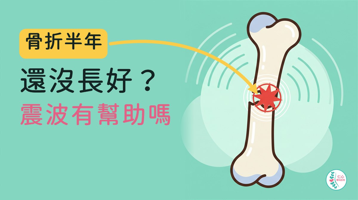 骨折半年還沒長好？震波有幫助嗎——插圖畫出一根長骨中段有縫隙，震波從外側傳向骨折處