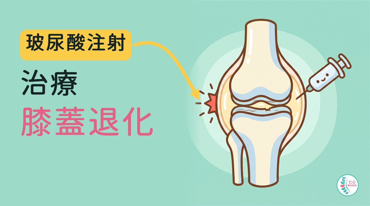 插畫：卡通膝關節，股骨與脛骨之間的軟骨變薄，關節腔內有淡黃色的凝膠，一支微笑的針筒從右側指向關節；左側大字「玻尿酸注射　治療　膝蓋退化」，黃色箭頭指向內側的紅色痛點，右下角是仁心骨科診所標誌。