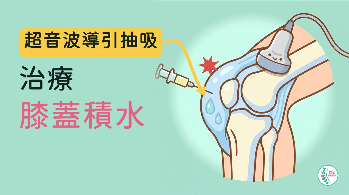 插畫：卡通膝關節，髕骨周圍的關節囊腫成水球狀、有水滴，超音波探頭放在膝蓋側面，針筒從側面伸入抽出淡黃色液體，旁邊有紅色痛點；左側大字「超音波導引抽吸　治療　膝蓋積水」，黃色箭頭指向腫脹處，右下角是仁心骨科診所標誌。