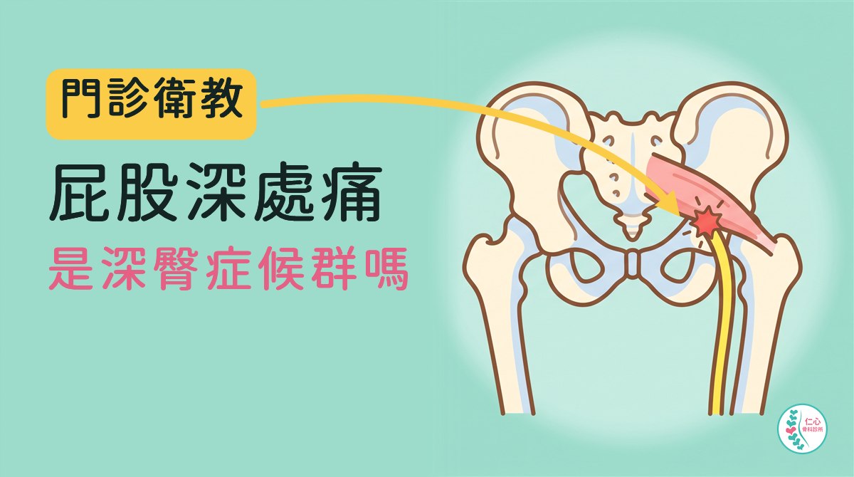 插畫：卡通骨盆與大腿骨，粉紅色的梨狀肌從薦骨斜跨到大腿骨上端，黃色的坐骨神經從它底下穿出往下走，交會處有紅色痛點；左側大字「門診衛教　屁股深處痛　是深臀症候群嗎」，黃色箭頭指向痛點，右下角是仁心骨科診所標誌。