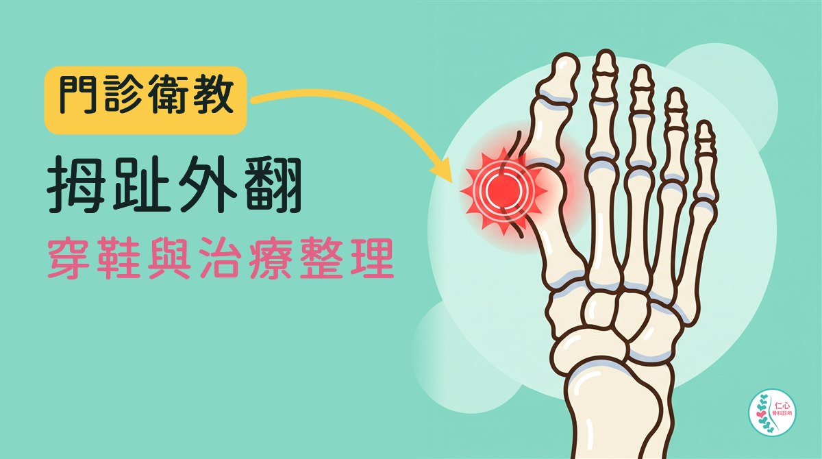 插畫：卡通腳骨俯視圖，大拇趾往第二趾方向歪，大拇趾根部內側突出處有紅色痛點；左側大字「門診衛教　拇趾外翻　穿鞋與治療整理」，黃色箭頭指向痛點，右下角是仁心骨科診所標誌。