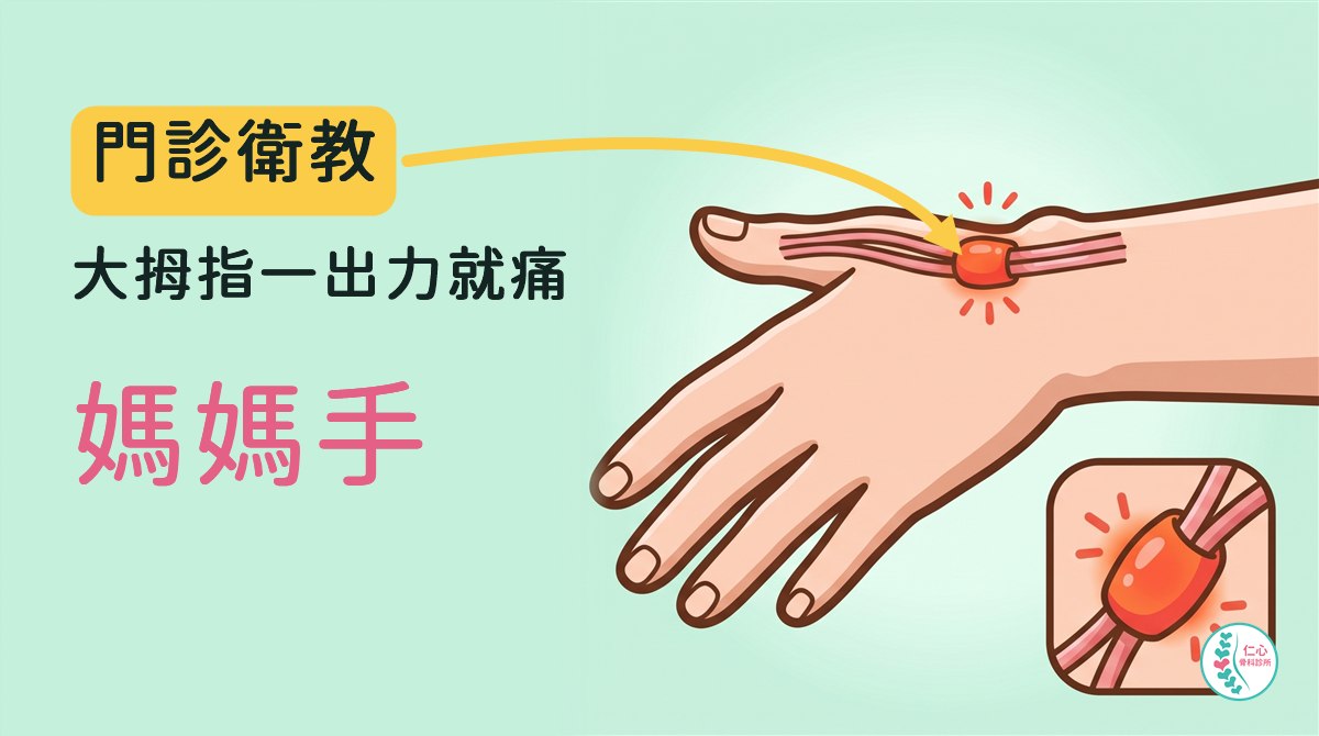 插畫：卡通手背與手腕，大拇指那一側手腕上兩條肌腱穿過一小段腱鞘，腱鞘紅腫發炎，右下角放大圖；左側大字「門診衛教　大拇指一出力就痛　媽媽手」，黃色箭頭指向紅腫的腱鞘，右下角是仁心骨科診所標誌。