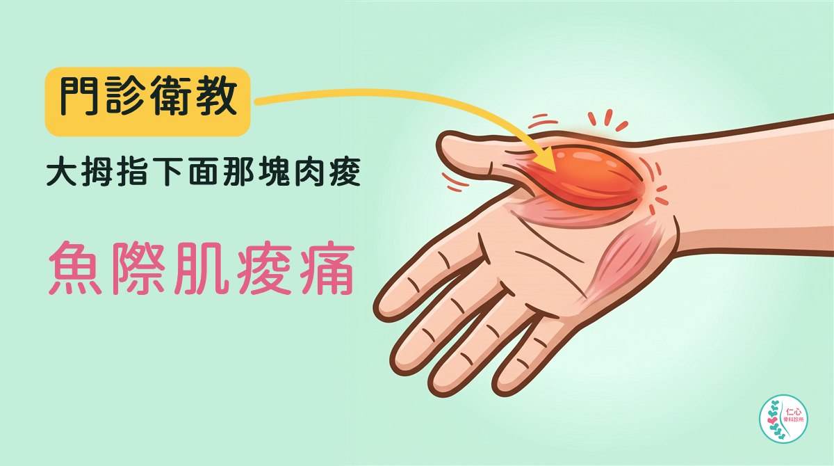插畫：卡通手掌，大拇指下面那塊鼓起來的肌肉（魚際肌）發紅緊繃；左側大字「門診衛教　大拇指下面那塊肉痠　魚際肌痠痛」，黃色箭頭指向發紅的肌肉，右下角是仁心骨科診所標誌。