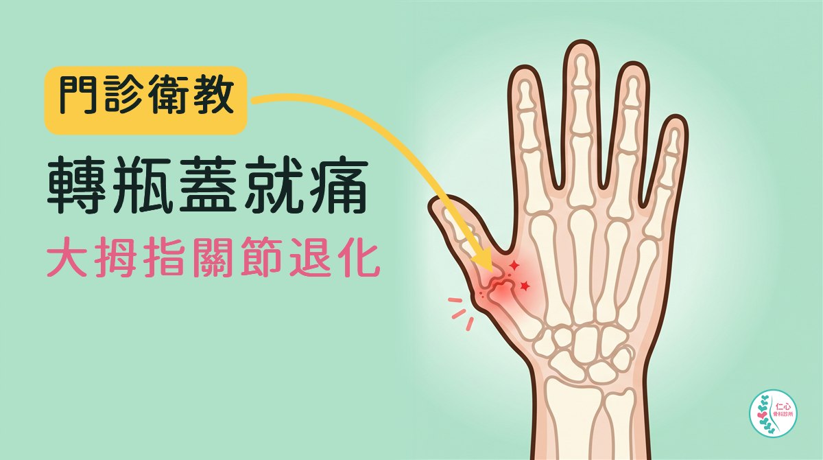 插畫：卡通手背骨頭圖，大拇指根部靠手腕的關節磨損、發紅；左側大字「門診衛教　轉瓶蓋就痛　大拇指關節退化」，黃色箭頭指向發紅的關節，右下角是仁心骨科診所標誌。