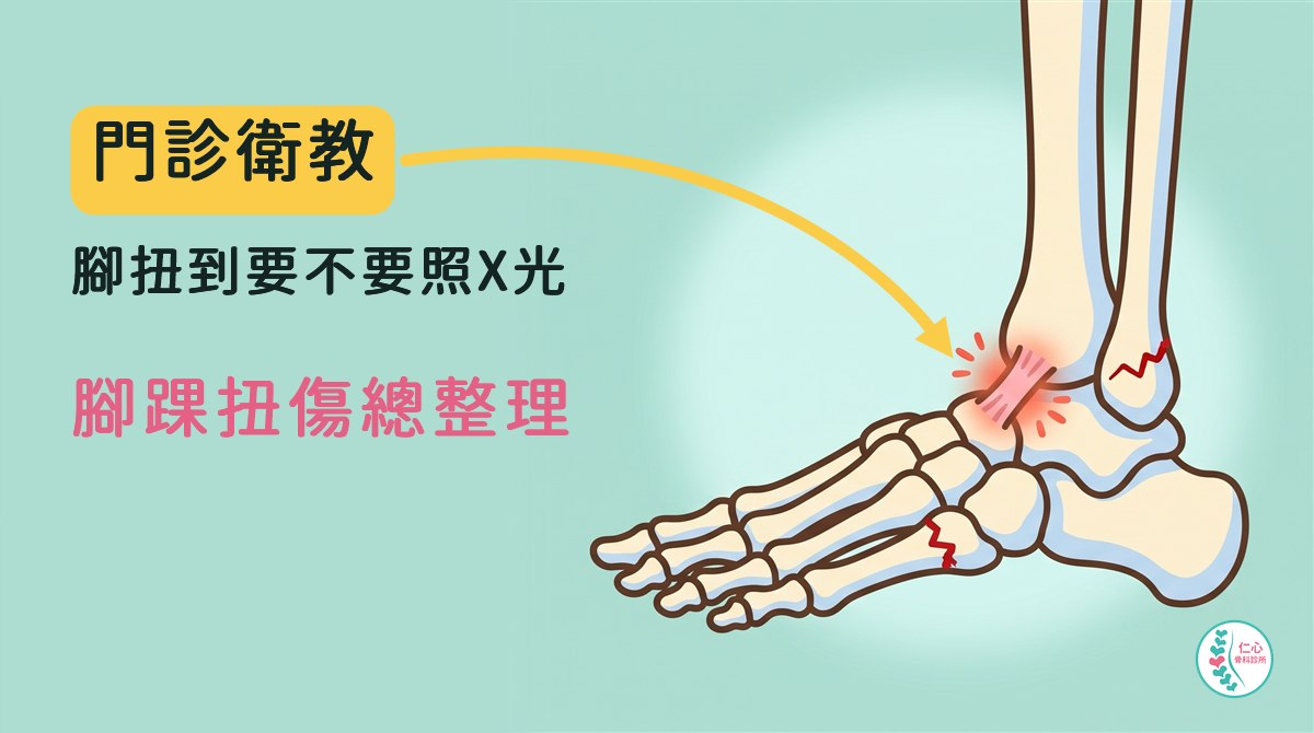 插畫：卡通腳踝骨頭從外側看，腳尖朝左，腳踝外側的韌帶發紅發炎，腳踝外側那塊骨頭的尖端與腳外側中段的第五蹠骨根部各有一條紅色裂線；左側大字「門診衛教　腳扭到要不要照X光　腳踝扭傷總整理」，黃色箭頭指向發紅的韌帶，右下角是仁心骨科診所標誌。