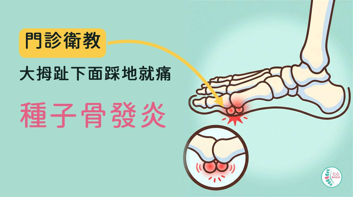 插畫：卡通腳骨從內側看，腳尖朝左，大拇趾根部腳底那一側有兩顆豆子大小的種子骨發紅發炎，下方放大圖；左側大字「門診衛教　大拇趾下面踩地就痛　種子骨發炎」，黃色箭頭指向發紅的種子骨，右下角是仁心骨科診所標誌。