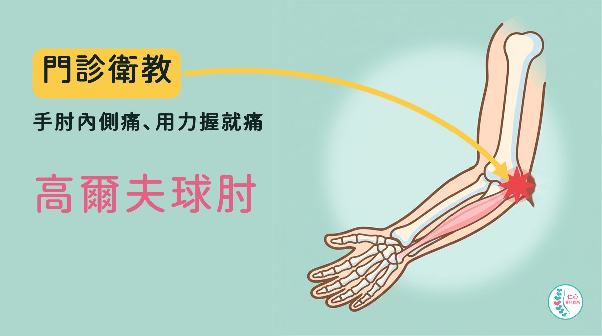 插畫：卡通右手臂骨頭，掌心朝上，前臂內側的肌肉從手肘內側骨突往手掌延伸，手肘內側骨突有紅色疼痛標記；左側大字「門診衛教　手肘內側痛、用力握就痛　高爾夫球肘」，黃色箭頭指向手肘內側，右下角是仁心骨科診所標誌。