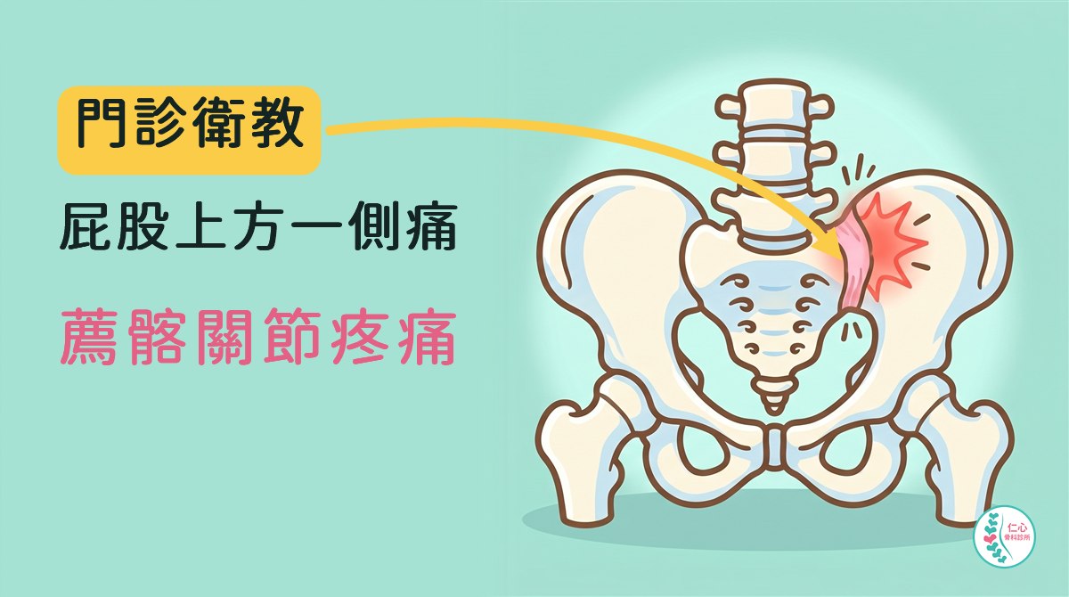 插畫：卡通骨盆從背面看，上面是腰椎，中間三角形的薦骨，兩側是骨盆；一側薦骨與骨盆交接處的薦髂關節韌帶發紅，旁邊有紅色疼痛標記；左側大字「門診衛教　屁股上方一側痛　薦髂關節疼痛」，黃色箭頭指向發紅的薦髂關節，右下角是仁心骨科診所標誌。