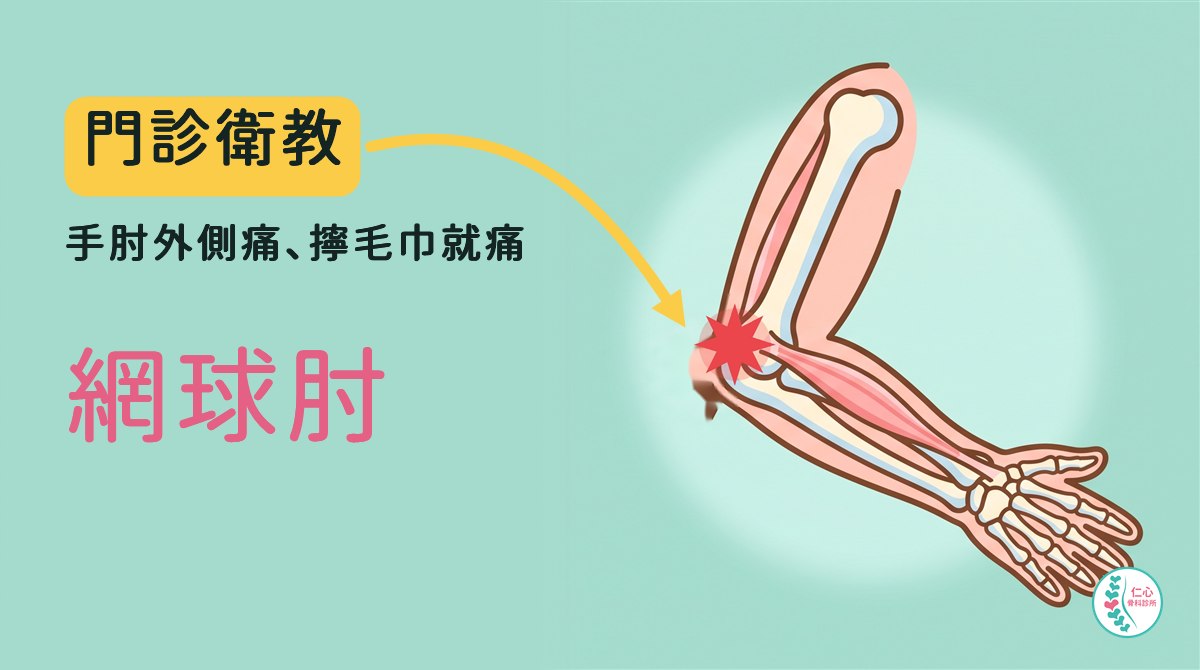 插畫：卡通右手臂骨頭從側面看，手肘彎曲、掌心朝下，前臂背側的肌肉從手肘外側骨突往手腕延伸，手肘外側骨突有紅色疼痛標記；左側大字「門診衛教　手肘外側痛、擰毛巾就痛　網球肘」，黃色箭頭指向手肘外側，右下角是仁心骨科診所標誌。