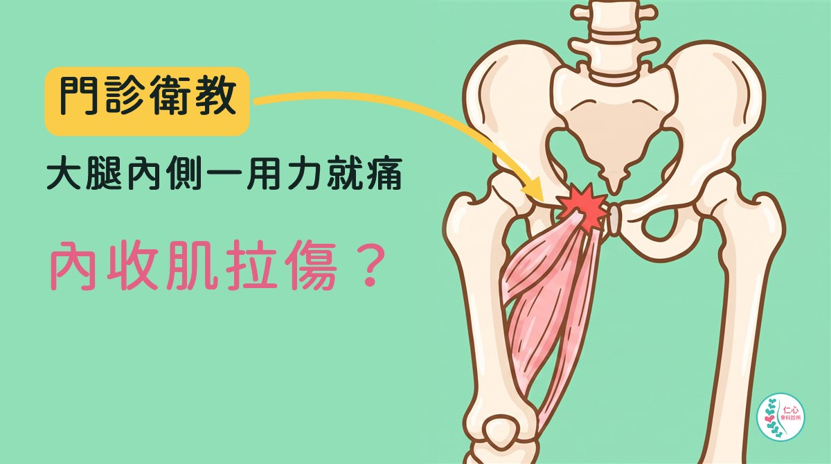 插畫：卡通骨盆與大腿骨，大腿內側一群粉紅色的內收肌，靠近恥骨的上端有紅色疼痛標記；左側大字「門診衛教　大腿內側一用力就痛　內收肌拉傷？」，黃色箭頭指向痛點，右下角是仁心骨科診所標誌。