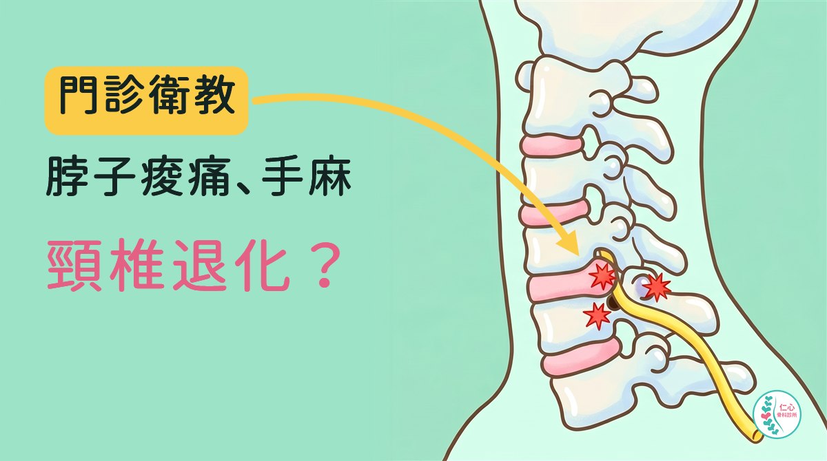 卡通插圖：頸椎側面圖，七節頸椎與椎間盤，黃色神經從頸椎下段往肩膀、手臂方向延伸，紅色星號標出椎間盤往後突出、神經出來的小洞與後方小面關節三處常見問題位置
