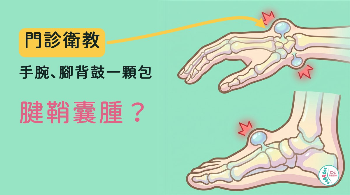 插畫：側面看的卡通手與腳，半透明可見骨頭；手背靠手腕處、手掌那面靠手腕處與腳背中段各長出一顆小小的淡藍色水滴狀囊腫，有細根連到骨頭，把皮膚頂出鼓包，旁邊有紅色標記；左側大字「門診衛教　手腕、腳背鼓一顆包　腱鞘囊腫？」，黃色箭頭指向手腕的囊腫，右下角是仁心骨科診所標誌。