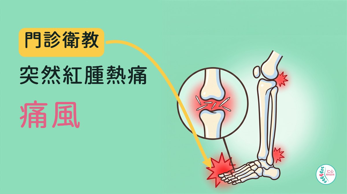 插畫：卡通骨頭畫的一條腿，從膝蓋到腳趾；大拇趾根部有大的紅色疼痛標記，腳踝和膝蓋各有小的紅色標記；旁邊圓形放大圖畫出大拇趾關節縫裡的白色針狀尿酸結晶與紅色發炎；左側大字「門診衛教　突然紅腫熱痛　痛風」，黃色箭頭指向大拇趾，右下角是仁心骨科診所標誌。