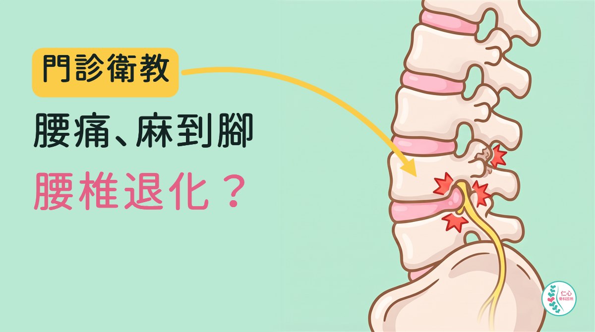 卡通插圖：腰椎側面圖，五節腰椎與椎間盤，黃色神經從腰椎下段往屁股、大腿方向延伸，紅色星號標出椎間盤往後突出、神經出來的小洞與後方小面關節三處常見問題位置