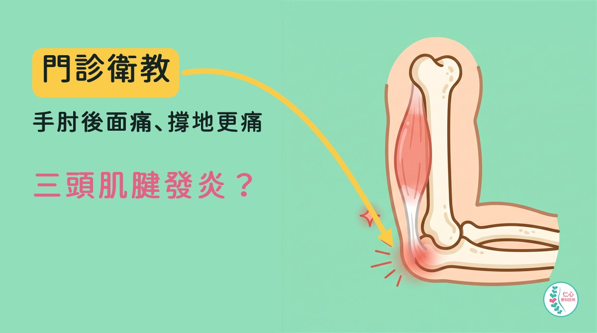 插畫：卡通右手肘側面，米白色骨頭，上臂後面的三頭肌往下變成肌腱接到手肘尖，接手肘尖的地方標紅色細線、旁邊一顆小紅星，肌腱是連著的；左側大字「門診衛教　手肘後面痛、撐地更痛　三頭肌腱發炎？」，黃色箭頭指向發炎處，右下角是仁心骨科診所標誌。