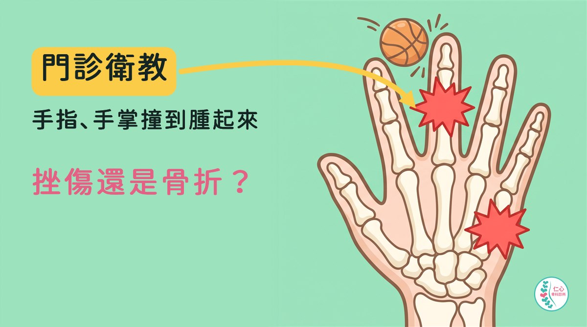 插畫：卡通右手手掌與手指骨頭，從手背看，一顆小籃球撞向中指指尖，中指中間關節與小指那側掌骨靠指根處各有紅色爆炸星；左側大字「門診衛教　手指、手掌撞到腫起來　挫傷還是骨折？」，黃色箭頭指向中指，右下角是仁心骨科診所標誌。