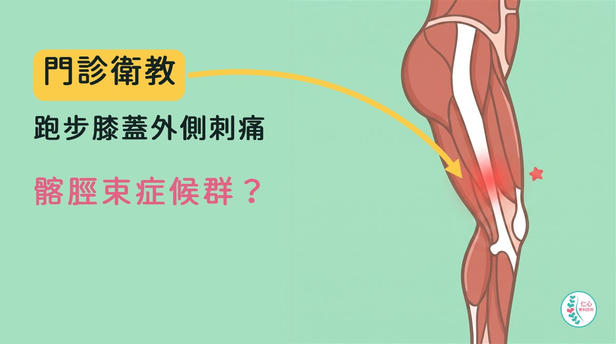 插畫：卡通右腿側面肌肉圖，一條白色的髂脛束從骨盆外側沿著大腿外側往下跨過膝蓋外側，膝關節上方、帶子經過膝蓋外側的地方有淡紅色光暈和一顆小紅星；左側大字「門診衛教　跑步膝蓋外側刺痛　髂脛束症候群？」，黃色箭頭指向膝蓋外側，右下角是仁心骨科診所標誌。