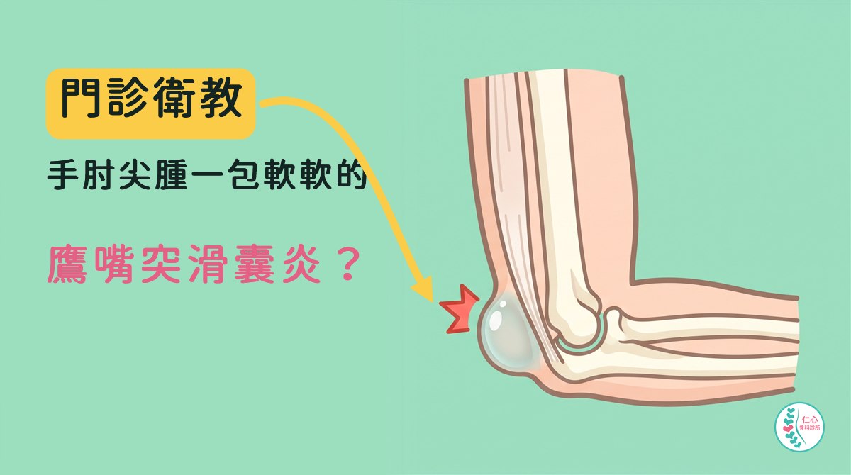 插畫：卡通右手肘骨頭，手肘彎成直角，手肘尖後方鼓起一顆半透明像小水球的滑囊，旁邊有紅色爆炸星；左側大字「門診衛教　手肘尖腫一包軟軟的　鷹嘴突滑囊炎？」，黃色箭頭指向滑囊，右下角是仁心骨科診所標誌。