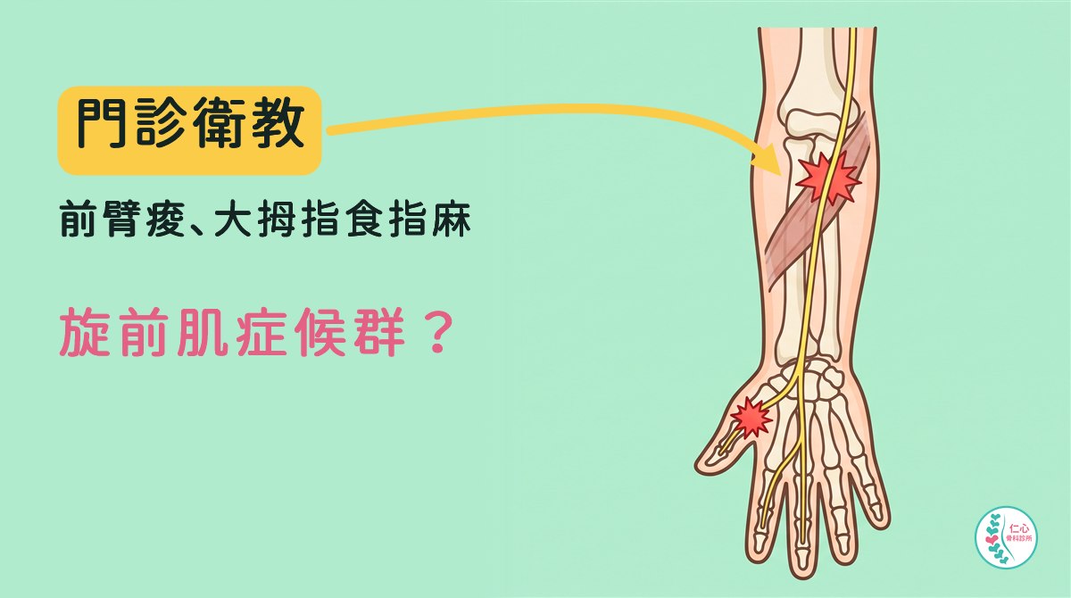 插畫：卡通右手前臂與手掌骨頭，從掌心那一面看，一條黃色神經從手肘往下穿過前臂上段斜斜的肌肉，一路延伸到大拇指、食指、中指；神經穿過肌肉處和大拇指根部各有紅色爆炸星；左側大字「門診衛教　前臂痠、大拇指食指麻　旋前肌症候群？」，黃色箭頭指向前臂上段，右下角是仁心骨科診所標誌。