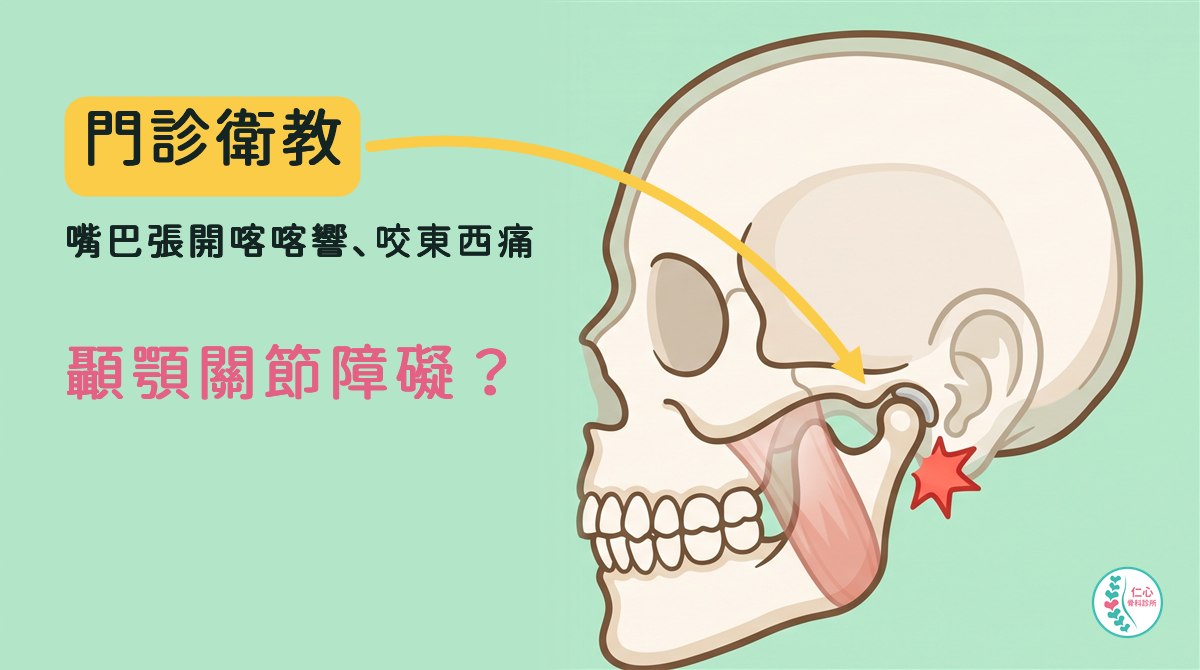 插畫：卡通頭骨側面，米白色骨頭，下顎骨的關節頭卡在耳朵正前方，淡紅色咬肌從顴骨連到下顎角，關節旁有紅色爆炸星；左側大字「門診衛教　嘴巴張開喀喀響、咬東西痛　顳顎關節障礙？」，黃色箭頭指向關節，右下角是仁心骨科診所標誌。