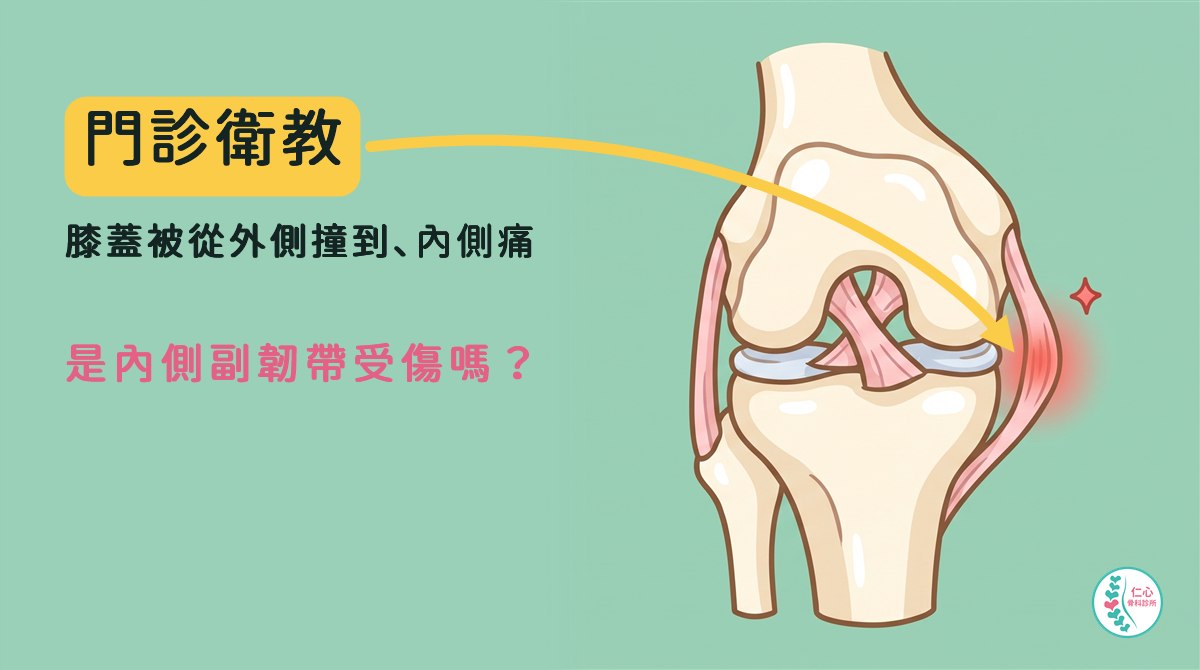 卡通膝蓋正面圖：膝蓋內側的內側副韌帶中段淡紅色光暈，旁邊一顆紅色小星星