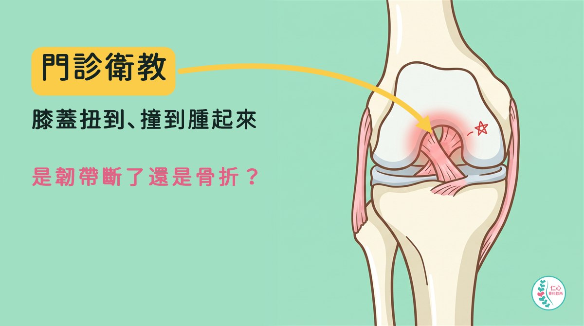卡通膝蓋正面圖：大腿骨、小腿骨、兩條交叉的十字韌帶、內外側副韌帶與半月板，十字韌帶處淡紅色光暈