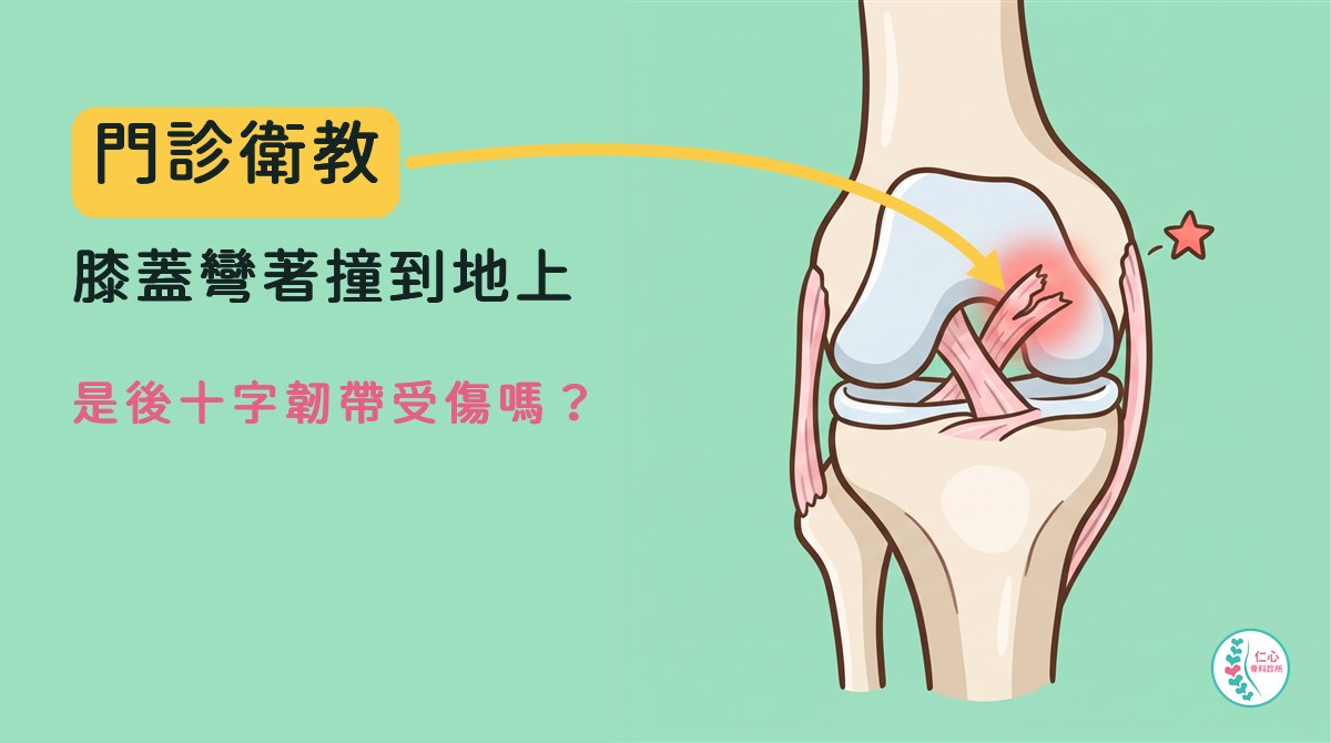 卡通膝蓋正面圖：關節中間斜向內側大腿骨的後十字韌帶部分撕裂，周圍淡紅色光暈
