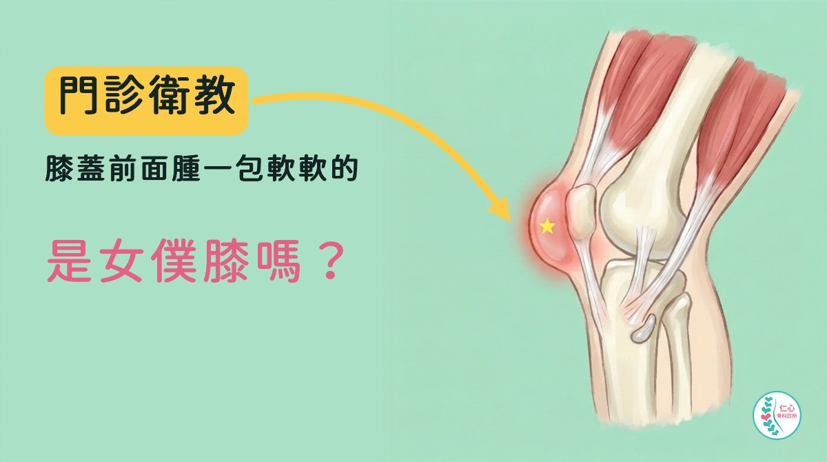 膝蓋側面插畫，膝蓋骨前方腫起的滑囊標出紅色痛點
