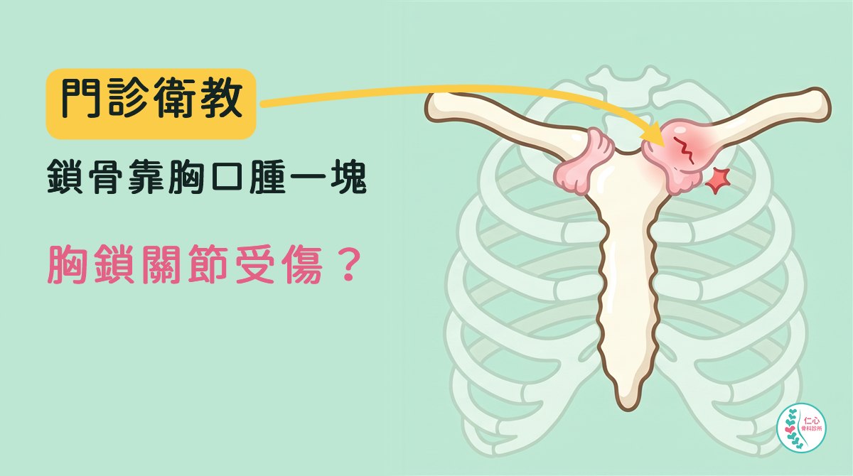 卡通插畫：胸口正面，胸骨上端與左右鎖骨，下方淡淡的肋骨；一側鎖骨與胸骨相接的胸鎖關節被粉紅色韌帶包住、微微紅腫，有一條細細的裂痕。