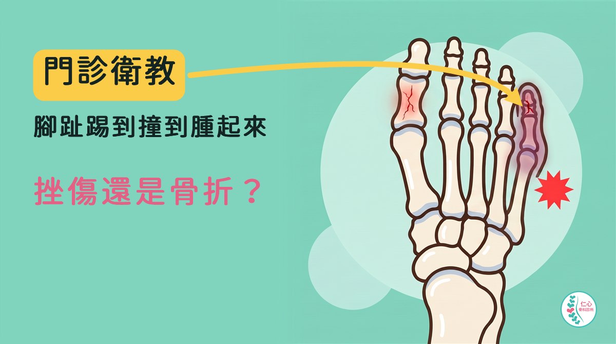 卡通插畫：右腳從腳背往下看，小趾和大拇趾前端的趾骨上各有一條細細的裂痕，小趾微微紅腫發紫。