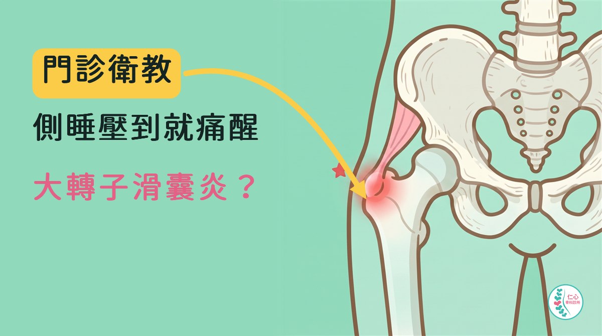 卡通插畫：右邊骨盆與大腿骨上端，從骨盆外側接到大腿骨外側凸骨（大轉子）的肌腱，接點微微紅腫。
